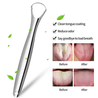 Portable Stainless Steel Tongue Scraper