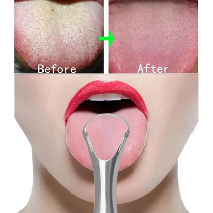 Portable Stainless Steel Tongue Scraper