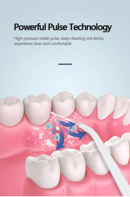 Advanced High-Pressure Oral Irrigator – Portable Dental Water Flosser for Deep Cleaning & Gum Care